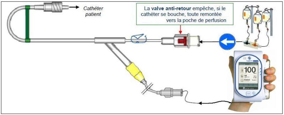 Pompe à perfusion portable - Droper - 1 voie / d'urgence / en continu